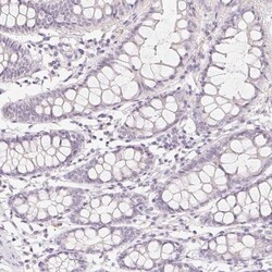 ZBBX Antibody, Novus Biologicals 25 &mu;L; Unlabeled:Antibodies, Polyclonal