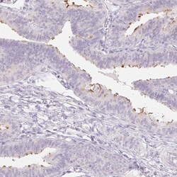 ZBBX Antibody, Novus Biologicals 25 &mu;L; Unlabeled:Antibodies, Polyclonal