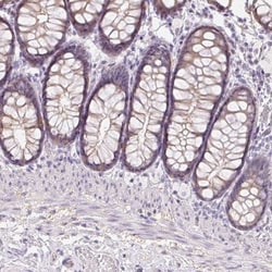 ZBBX Antibody, Novus Biologicals 0.1mL; Unlabeled:Antibodies, Polyclonal