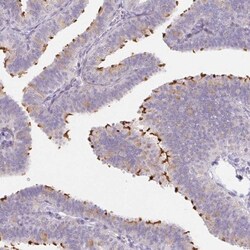 ZBBX Antibody, Novus Biologicals 0.1mL; Unlabeled:Antibodies, Polyclonal