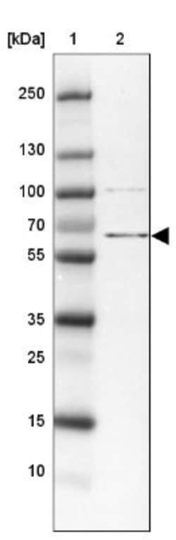 ZBED5 Antibody, Novus Biologicals 25 &mu;L, Unlabeled:Antibodies, Polyclonal
