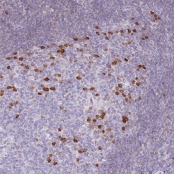 ZBP1/DLM-1/DAI Antibody, Novus Biologicals 0.1mL; Unlabeled:Antibodies,