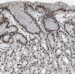 ZBTB10 Antibody, Novus Biologicals 25 &mu;L | Buy Online | Novus Biologicals | Fisher Scientific