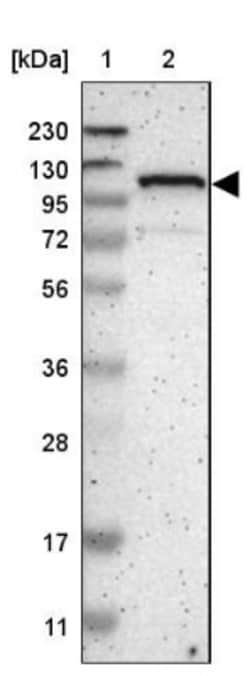 ZBTB11 Antibody, Novus Biologicals:Antibodies:Primary Antibodies