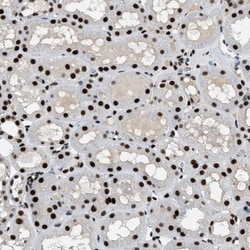 ZBTB20 Antibody, Novus Biologicals:Antibodies:Primary Antibodies