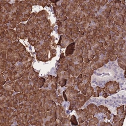 ZBTB24 Antibody, Novus Biologicals 25 &mu;L, Unlabeled:Antibodies, Polyclonal