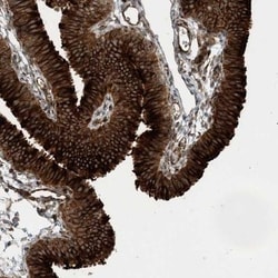 ZBTB3 Antibody, Novus Biologicals 25 &mu;L; Unlabeled:Antibodies, Polyclonal