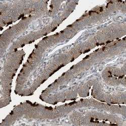 ZBTB3 Antibody, Novus Biologicals 25 &mu;L; Unlabeled:Antibodies, Polyclonal