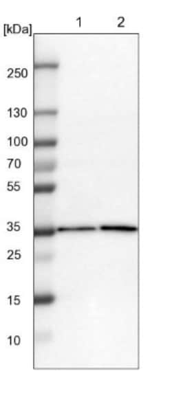 ZBTB37 Antibody, Novus Biologicals 25ul | Buy Online | Novus Biologicals | Fisher Scientific