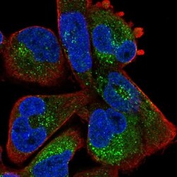 ZBTB39 Antibody, Novus Biologicals 0.1mL; Unlabeled:Antibodies, Polyclonal