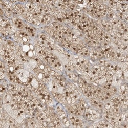ZBTB41 Antibody, Novus Biologicals 25 &mu;L; Unlabeled:Antibodies, Polyclonal