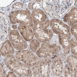 ZBTB48 Antibody, Novus Biologicals:Antibodies:Primary Antibodies