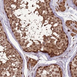 ZBTB5 Antibody, Novus Biologicals:Antibodies:Primary Antibodies