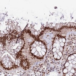 ZBTB7A/Pokemon Antibody, Novus Biologicals 25 &mu;L | Buy Online | Novus Biologicals | Fisher Scientific