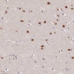 ZBTB7A/Pokemon Antibody, Novus Biologicals 25 &mu;L | Buy Online | Novus Biologicals | Fisher Scientific