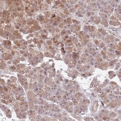 ZBTB7A/Pokemon Antibody, Novus Biologicals 25 &mu;L | Buy Online | Novus Biologicals | Fisher Scientific