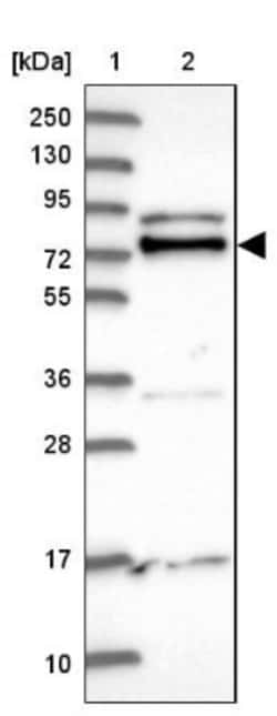 ZBTB7A/Pokemon Antibody, Novus Biologicals 25 &mu;L | Buy Online | Novus Biologicals | Fisher Scientific