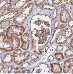 ZC3H10 Antibody, Novus Biologicals:Antibodies:Primary Antibodies