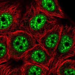 ZC3H14 Antibody, Novus Biologicals 0.1mL; Unlabeled:Antibodies, Polyclonal