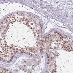 ZC3H14 Antibody, Novus Biologicals 0.1mL; Unlabeled:Antibodies, Polyclonal