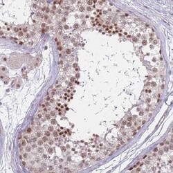 ZC3H14 Antibody, Novus Biologicals 0.1mL; Unlabeled:Antibodies, Polyclonal