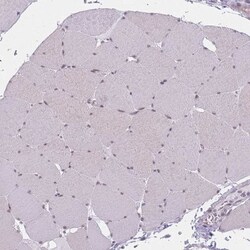 ZC3H14 Antibody, Novus Biologicals 0.1mL; Unlabeled:Antibodies, Polyclonal