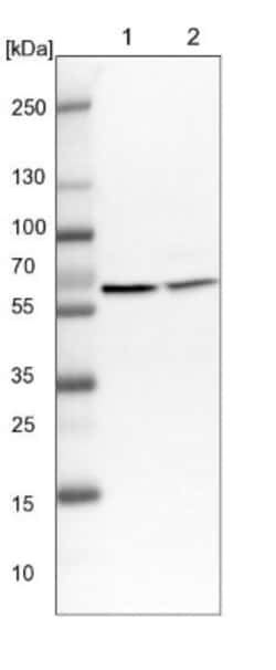 ZC3H15 Antibody, Novus Biologicals 0.1mL; Unlabeled:Antibodies, Polyclonal