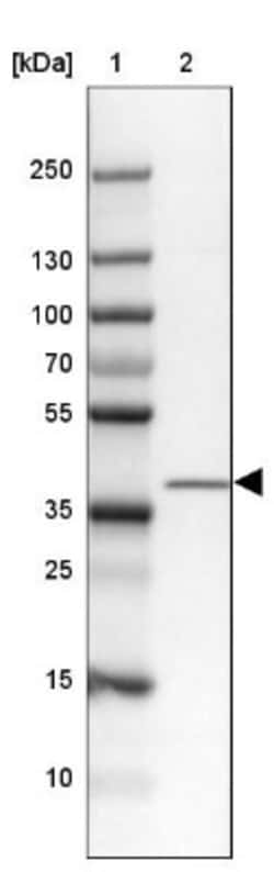 ZC3H8 Antibody, Novus Biologicals:Antibodies:Primary Antibodies