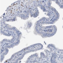 ZCCHC12 Antibody, Novus Biologicals:Antibodies:Primary Antibodies