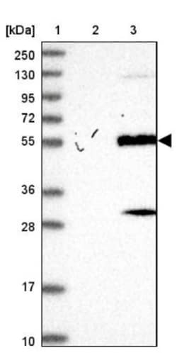 ZCCHC12 Antibody, Novus Biologicals 0.1mL; Unlabeled:Antibodies, Polyclonal