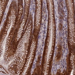 ZCCHC2 Antibody, Novus Biologicals:Antibodies:Primary Antibodies
