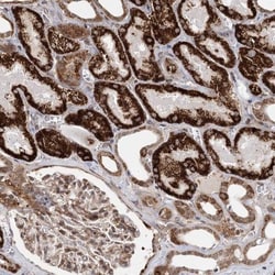 ZCCHC24 Antibody, Novus Biologicals 25 &mu;L; Unlabeled:Antibodies, Polyclonal