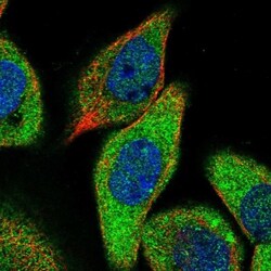 ZCCHC6 Antibody, Novus Biologicals:Antibodies:Primary Antibodies