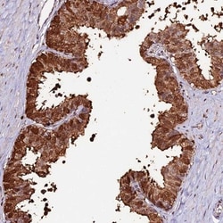 ZDBF2 Antibody, Novus Biologicals 0.1mL; Unlabeled:Antibodies, Polyclonal