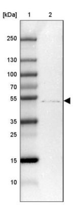 ZDHHC1 Antibody, Novus Biologicals:Antibodies:Primary Antibodies
