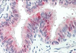 ZDHHC13 Antibody, Novus Biologicals 0.1mg; Unlabeled:Antibodies, Polyclonal