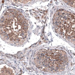 ZDHHC14 Antibody, Novus Biologicals 0.1mL; Unlabeled:Antibodies, Polyclonal
