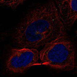 ZDHHC17 Antibody, Novus Biologicals 25 &mu;L; Unlabeled:Antibodies, Polyclonal