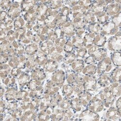 ZDHHC20 Antibody, Novus Biologicals 25 &mu;L; Unlabeled:Antibodies, Polyclonal