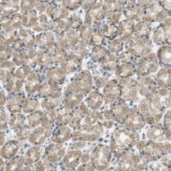 ZDHHC20 Antibody, Novus Biologicals 25 &mu;L; Unlabeled:Antibodies, Polyclonal