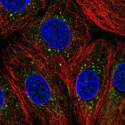 ZDHHC24 Antibody, Novus Biologicals 0.1mL; Unlabeled:Antibodies, Polyclonal
