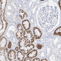 ZDHHC4 Antibody, Novus Biologicals 0.1mL; Unlabeled:Antibodies, Polyclonal