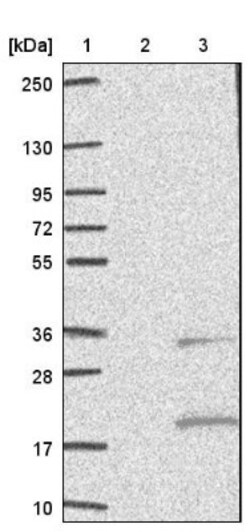 ZDHHC4 Antibody, Novus Biologicals 0.1mL; Unlabeled:Antibodies, Polyclonal