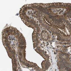 ZDHHC5 Antibody, Novus Biologicals 0.1 mL | Buy Online | Novus Biologicals | Fisher Scientific