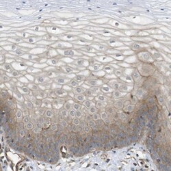 ZDHHC5 Antibody, Novus Biologicals 0.1 mL | Buy Online | Novus Biologicals | Fisher Scientific