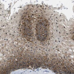 ZDHHC5 Antibody, Novus Biologicals 0.1 mL | Buy Online | Novus Biologicals | Fisher Scientific