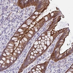 ZDHHC7 Antibody, Novus Biologicals:Antibodies:Primary Antibodies