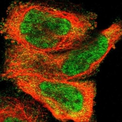ZDHHC8 Antibody, Novus Biologicals:Antibodies:Primary Antibodies