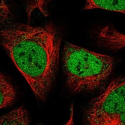 ZEB1 Antibody, Novus Biologicals 0.1mL; Unlabeled:Antibodies, Polyclonal
