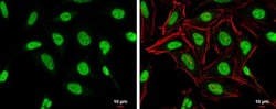 ZEB1 Antibody, Novus Biologicals 0.1mL; Unlabeled:Antibodies, Polyclonal